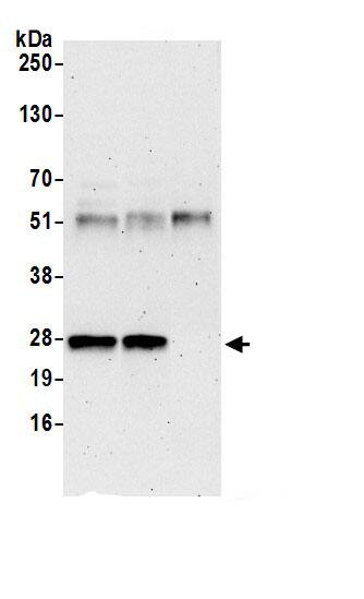 Immunoprecipitation:RPL10A AntibodyNBP3-29541] -Detection of human RPL10A by western blot of immunoprecipitates. Samples: Whole cell lysate (0.5 or 1.0 mg per IP reaction; 20% of IP loaded) from 293T cells prepared using NETN lysis buffer. Antibodies: Affinity purified rabbit anti-RPL10A antibody NBP3-29541 (lot NBP3-29541-1) used for IP at 6 µg per reaction. RPL10A was also immunoprecipitated by rabbit anti-RPL10A.. For blotting immunoprecipitated RPL10A, NBP3-29541 was used at 0.4 µg/ml. Detection: Chemiluminescence with an exposure time of 3 minutes.