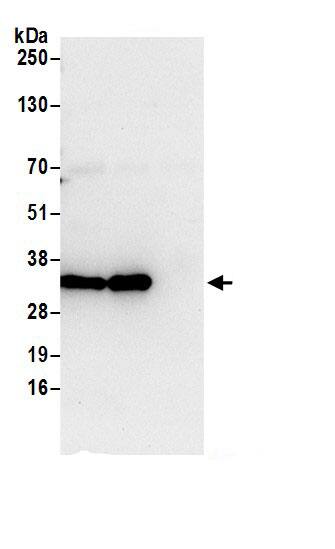 Immunoprecipitation:HPRT AntibodyNBP3-29542] -Detection of human HPRT1 by western blot of immunoprecipitates. Samples: Whole cell lysate (0.5 or 1.0 mg per IP reaction; 20% of IP loaded) from 293T cells prepared using NETN lysis buffer. Antibodies: Affinity purified rabbit anti-HPRT1 antibody NBP3-29542 (lot NBP3-29542-1) used for IP at 6 µg per reaction. HPRT1 was also immunoprecipitated by rabbit anti-HPRT1.. For blotting immunoprecipitated HPRT1, NBP3-29542 was used at 1 µg/ml. Detection: Chemiluminescence with an exposure time of 10 seconds.