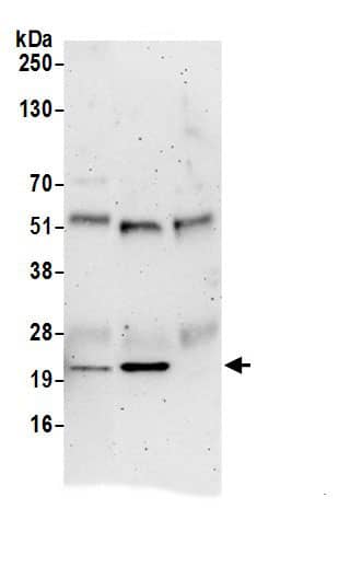 Immunoprecipitation:Tmp21/p23 AntibodyNBP3-29543] -Detection of human TMED10 by western blot of immunoprecipitates. Samples: Whole cell lysate (0.5 or 1.0 mg per IP reaction; 20% of IP loaded) from 293T cells prepared using NETN lysis buffer. Antibodies: Affinity purified rabbit anti-TMED10 antibody NBP3-29543 (lot NBP3-29543-1) used for IP at 6 µg per reaction. TMED10 was also immunoprecipitated by rabbit anti-TMED10.. For blotting immunoprecipitated TMED10, NBP3-29543 was used at 1 µg/ml. Detection: Chemiluminescence with an exposure time of 3 minutes.