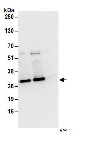 Immunoprecipitation:UBE2S AntibodyNBP3-29545] -Detection of human E2-EPF by western blot of immunoprecipitates. Samples: Whole cell lysate (1 mg for IP; 20% of IP loaded) from 293T cells. Antibodies: Affinity purified rabbit anti-E2-EPF antibody NBP3-29545 (lot NBP3-29545-1) used for IP at 6 µg/mg lysate. E2-EPF was also immunoprecipitated by rabbit anti-E2-EPF.. For blotting immunoprecipitated E2-EPF, NBP3-29545 was used at 1 µg/ml. Detection: Chemiluminescence with an exposure time of 10 seconds.