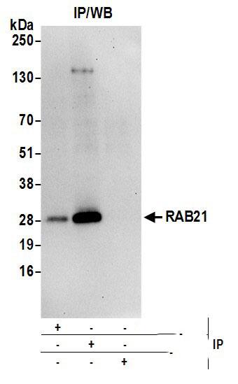 Immunoprecipitation:[NBP3-29546]-Detection of human RAB21 by western blot of immunoprecipitates. Samples: Whole cell lysate from 293T cells prepared using NETN lysis buffer. Antibodies: Affinity purified rabbit anti-RAB21 antibody used for IP at 6 µg per reaction. RAB21 was also immunoprecipitated by rabbit anti-RAB21 antibody. For blotting immunoprecipitated RAB21, was used at 1 µg/ml. Detection: Chemiluminescence with an exposure time of 30 seconds.
