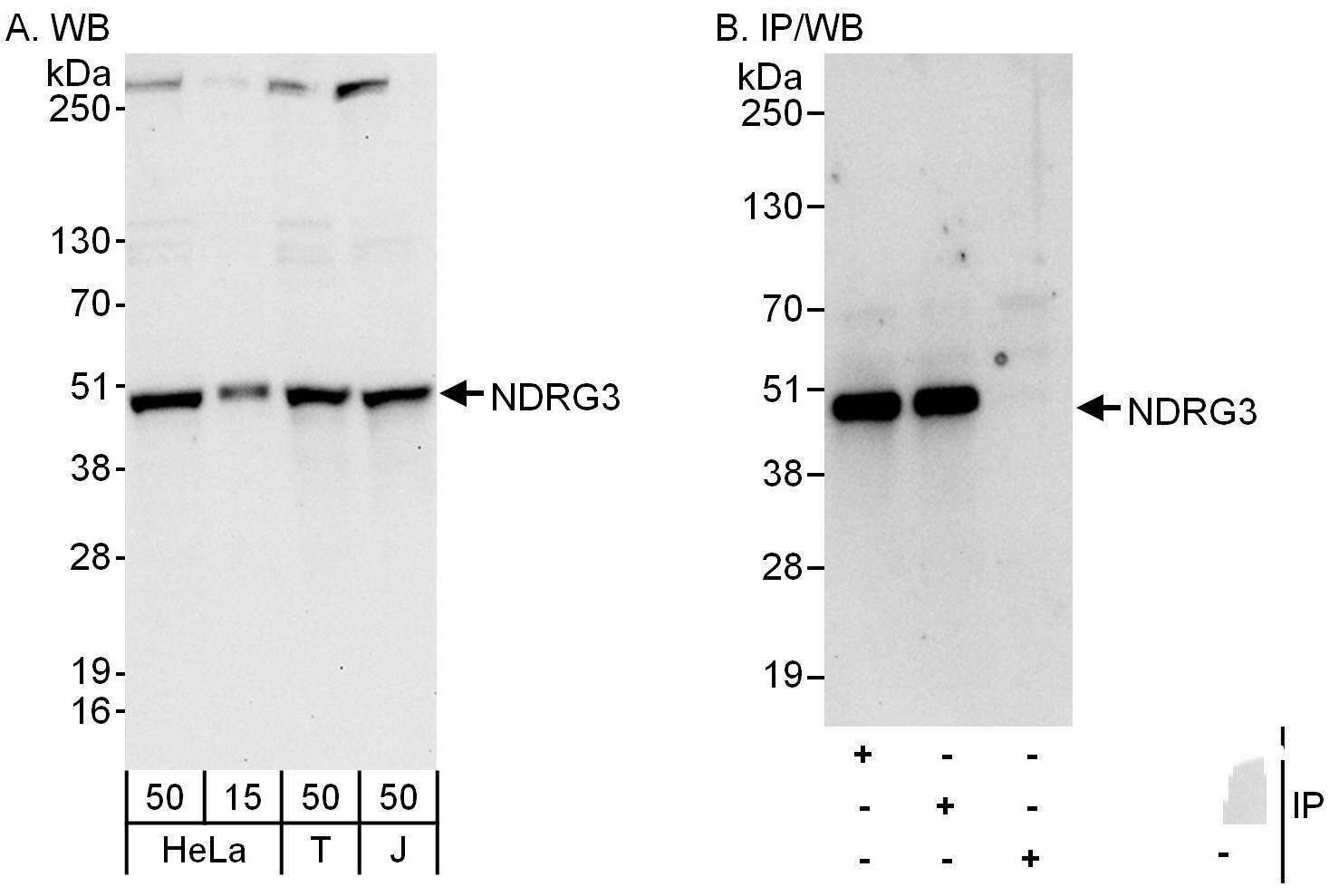 Western Blot:[NBP3-29548]-Detection of human NDRG3 by western blot and immunoprecipitation. Samples: Whole cell lysate from HeLa , HEK293T and Jurkat cells. Antibodies: Affinity purified rabbit anti-NDRG3 antibody used for WB at 0. 1 µg/ml and 1 µg/ml and used for IP at 6 µg/mg lysate. NDRG3 was also immunoprecipitated by rabbit anti-NDRG3 antibody , which recognizes an upstream epitope. Detection: Chemiluminescence with exposure times of 30 seconds and 10 seconds.