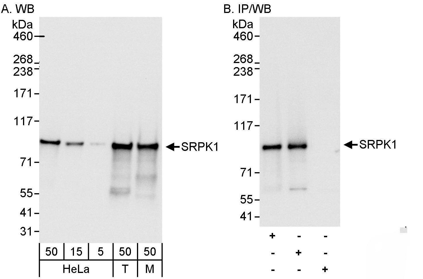 Western Blot:[NBP3-29549]-Detection of human and mouse SRPK1 by western blot and immunoprecipitation. Samples: Whole cell lysate from HeLa , HEK293T , and mouse NIH 3T3 cells. Antibodies: Affinity purified rabbit anti-SRPK1 antibody used for WB at 0. 04 µg/ml and 1 µg/ml and used for IP at 3 µg/mg lysate. SRPK1 was also immunoprecipitated by rabbit anti-SRPK1 antibody , which recognizes an upstream epitope. Detection: Chemiluminescence with exposure times of 3 seconds and 1 second.