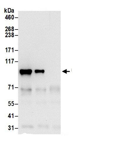 Immunoprecipitation:Beta 2 Adaptin AntibodyNBP3-29552] -Detection of human Beta-2-adaptin by western blot of immunoprecipitates. Samples: Whole cell lysate (0.5 or 1.0 mg per IP reaction; 20% of IP loaded) from 293T cells prepared using NETN lysis buffer. Antibodies: Affinity purified rabbit anti-Beta-2-adaptin antibody NBP3-29552 (lot NBP3-29552-1) used for IP at 6 µg per reaction. Beta-2-adaptin was also immunoprecipitated by rabbit anti-Beta-2-adaptin.. For blotting immunoprecipitated Beta-2-adaptin, NBP3-29552 was used at 1 µg/ml. Detection: Chemiluminescence with an exposure time of 10 seconds.