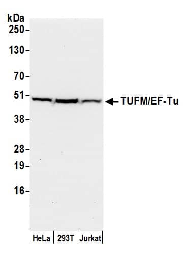 Western Blot:[NBP3-29553]-Detection of human TUFM/EF-Tu by western blot. Samples: Whole cell lysate from HeLa, HEK293T, and Jurkat cells prepared using NETN lysis buffer. Antibody: Affinity purified rabbit anti-TUFM/EF-Tu antibody used for WB at 0. 1 µg/ml. Detection: Chemiluminescence with an exposure time of 10 seconds.