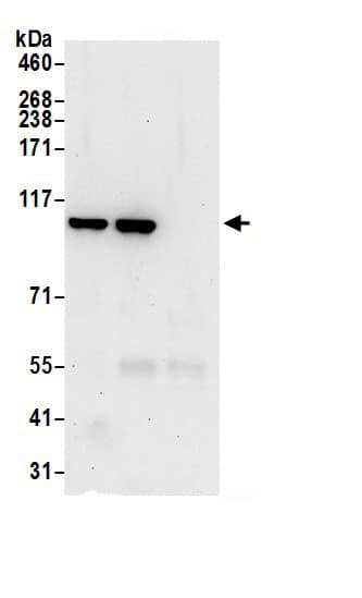 Immunoprecipitation:MVP AntibodyNBP3-29557] -Detection of human MVP by western blot of immunoprecipitates. Samples: Whole cell lysate (0.5 or 1.0 mg per IP reaction; 20% of IP loaded) from HeLa cells prepared using NETN lysis buffer. Antibodies: Affinity purified rabbit anti-MVP antibody NBP3-29557 (lot NBP3-29557-1) used for IP at 6 µg per reaction. MVP was also immunoprecipitated by rabbit anti-MVP.. For blotting immunoprecipitated MVP, NBP3-29557 was used at 1 µg/ml. Detection: Chemiluminescence with an exposure time of 30 seconds.