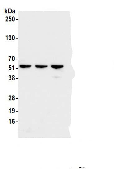 Immunoprecipitation:ATP5A AntibodyNBP3-29561] -Detection of human ATP5A1 by western blot of immunoprecipitates. Samples: Whole cell lysate (1.0 mg per IP reaction; 5% of IP loaded) from HEK293T cells prepared using NETN lysis buffer. Antibodies: Affinity purified rabbit anti-ATP5A1 antibody (NBP3-29561 lot 2) used for IP at 6 µg per reaction. ATP5A1 was also immunoprecipitated by a previous lot of this antibody (NBP3-29561 lot 1) and a second.inst a different epitope of ATP5A1 (A304-940A). For blotting immunoprecipitated ATP5A1, NBP3-29561 was used at 0.04 µg/ml. Detection: Chemiluminescence with an exposure time of 1 second.