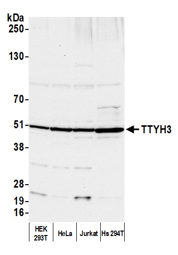 Western Blot TTYH3 Antibody - BSA Free
