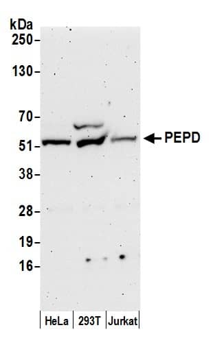 Western Blot:[NBP3-29564]-Detection of human PEPD by western blot. Samples: Whole cell lysate from HeLa, HEK293T, and Jurkat cells prepared using NETN lysis buffer. Antibody: Affinity purified rabbit anti-PEPD antibody used for WB at 0. 1 µg/ml. Detection: Chemiluminescence with an exposure time of 3 minutes.