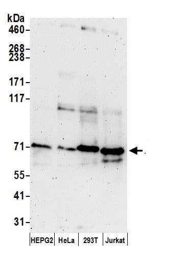 Western Blot:[NBP3-29565]-Detection of human ACSS2 by western blot. Samples: Whole cell lysate from Hep-G2, HeLa, HEK293T, and Jurkat cells prepared using NETN lysis buffer. Antibody: Affinity purified rabbit anti-ACSS2 antibody used for WB at 0. 1 µg/ml. Detection: Chemiluminescence with an exposure time of 3 minutes.