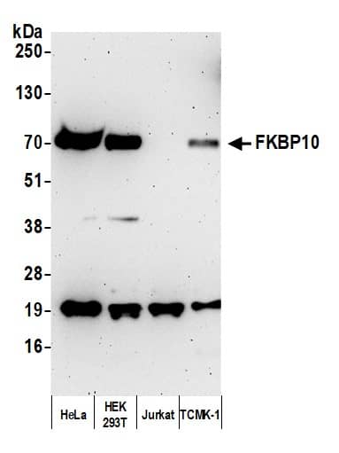 Western Blot:[NBP3-29566]-Detection of human and mouse FKBP10 by western blot. Samples: Whole cell lysate from HeLa, HEK293T, Jurkat, and TCMK-1 cells prepared using NETN lysis buffer. Antibody: Affinity purified rabbit anti-FKBP10 antibody used for WB at 0. 1 µg/ml. Detection: Chemiluminescence with an exposure time of 3 minutes.