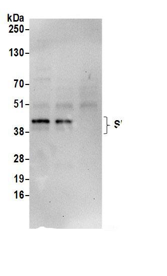 Immunoprecipitation:SNURPORTIN1 AntibodyNBP3-29567] -Detection of human SNUPN by western blot of immunoprecipitates. Samples: Whole cell lysate (0.5 or 1.0 mg per IP reaction; 20% of IP loaded) from 293T cells prepared using NETN lysis buffer. Antibodies: Affinity purified rabbit anti-SNUPN antibody NBP3-29567 (lot NBP3-29567-1) used for IP at 6 µg per reaction. SNUPN was also immunoprecipitated by rabbit anti-SNUPN.. For blotting immunoprecipitated SNUPN, NBP3-29567 was used at 0.4 µg/ml. Detection: Chemiluminescence with an exposure time of 30 seconds.