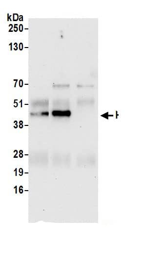 Immunoprecipitation:Cyclophilin 40 AntibodyNBP3-29569] -Detection of human PPID by western blot of immunoprecipitates. Samples: Whole cell lysate (0.5 or 1.0 mg per IP reaction; 20% of IP loaded) from 293T cells prepared using NETN lysis buffer. Antibodies: Affinity purified rabbit anti-PPID antibody NBP3-29569 (lot NBP3-29569-1) used for IP at 6 µg per reaction. PPID was also immunoprecipitated by rabbit anti-PPID.. For blotting immunoprecipitated PPID, NBP3-29569 was used at 0.4 µg/ml. Detection: Chemiluminescence with an exposure time of 30 seconds.