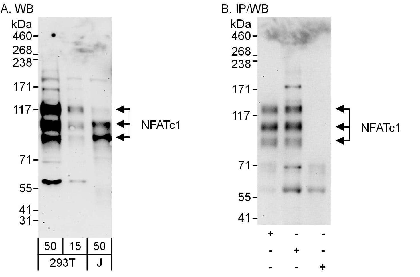 Western Blot:[NBP3-29572]-Detection of human NFATc1 by western blot and immunoprecipitation. Samples: Whole cell lysate from HEK293T and Jurkat cells. Antibodies: Affinity purified rabbit anti-NFATc1 antibody used for WB at 0. 1 µg/ml and 1 µg/ml and used for IP at 6 µg/mg lysate. NFATc1 was also immunoprecipitated by rabbit anti-NFATc1 antibody , which recognizes an upstream epitope. Detection: Chemiluminescence with exposure times of 3 minutes and 30 seconds.