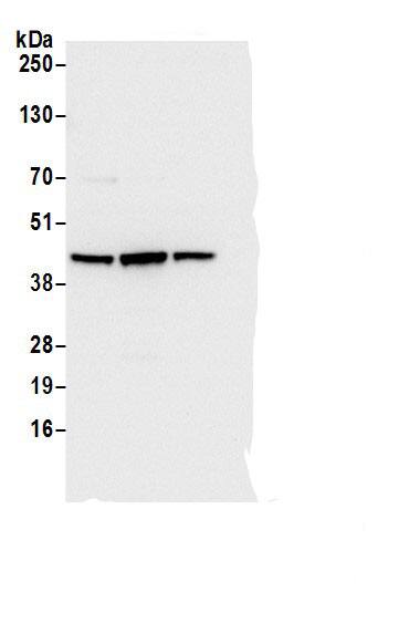 Immunoprecipitation:Adenosine Deaminase/ADA AntibodyNBP3-29574] -Detection of human ADA by western blot of immunoprecipitates. Samples: Whole cell lysate (0.5 or 1.0 mg per IP reaction; 20% of IP loaded) from Jurkat cells prepared using NETN lysis buffer. Antibodies: Affinity purified rabbit anti-ADA antibody NBP3-29574 (lot NBP3-29574-1) used for IP at 6 µg per reaction. ADA was also immunoprecipitated by a rabbit anti-ADA antibodies A305-183A and BL20481. For blotting immunoprecipitated ADA, NBP3-29574 was used at 0.4 µg/ml. Detection: Chemiluminescence with an exposure time of 3 seconds.