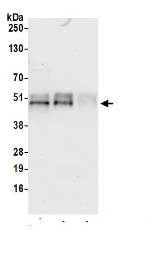 Immunoprecipitation:TC-PTP/PTPN2 AntibodyNBP3-29575] -Detection of human PTPN2 by western blot of immunoprecipitates. Samples: Whole cell lysate (0.5 or 1.0 mg per IP reaction; 20% of IP loaded) from HeLa cells prepared using NETN lysis buffer. Antibodies: Affinity purified rabbit anti-PTPN2 antibody NBP3-29575 (lot NBP3-29575-1) used for IP at 6 µg per reaction. PTPN2 was also immunoprecipitated by rabbit anti-PTPN2.. For blotting immunoprecipitated PTPN2, NBP3-29575 was used at 1 µg/ml. Detection: Chemiluminescence with an exposure time of 10 seconds.