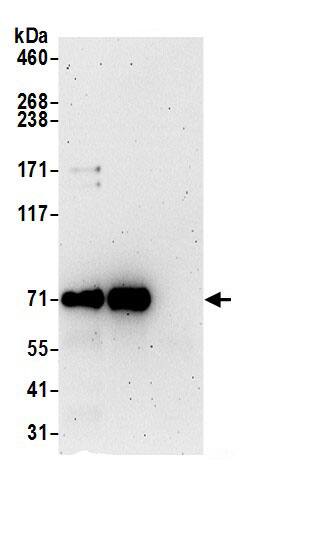 Immunoprecipitation:UBQLN4/CIP75 AntibodyNBP3-29576] -Detection of human UBQLN4 by western blot of immunoprecipitates. Samples: Whole cell lysate (0.5 or 1.0 mg per IP reaction; 20% of IP loaded) from 293T cells prepared using NETN lysis buffer. Antibodies: Affinity purified rabbit anti-UBQLN4 antibody NBP3-29576 (lot NBP3-29576-1) used for IP at 6 µg per reaction. UBQLN4 was also immunoprecipitated by rabbit anti-UBQLN4 antibody BL20642. For blotting immunoprecipitated UBQLN4, NBP3-29576 was used at 0.4 µg/ml. Detection: Chemiluminescence with an exposure time of 3 minutes.