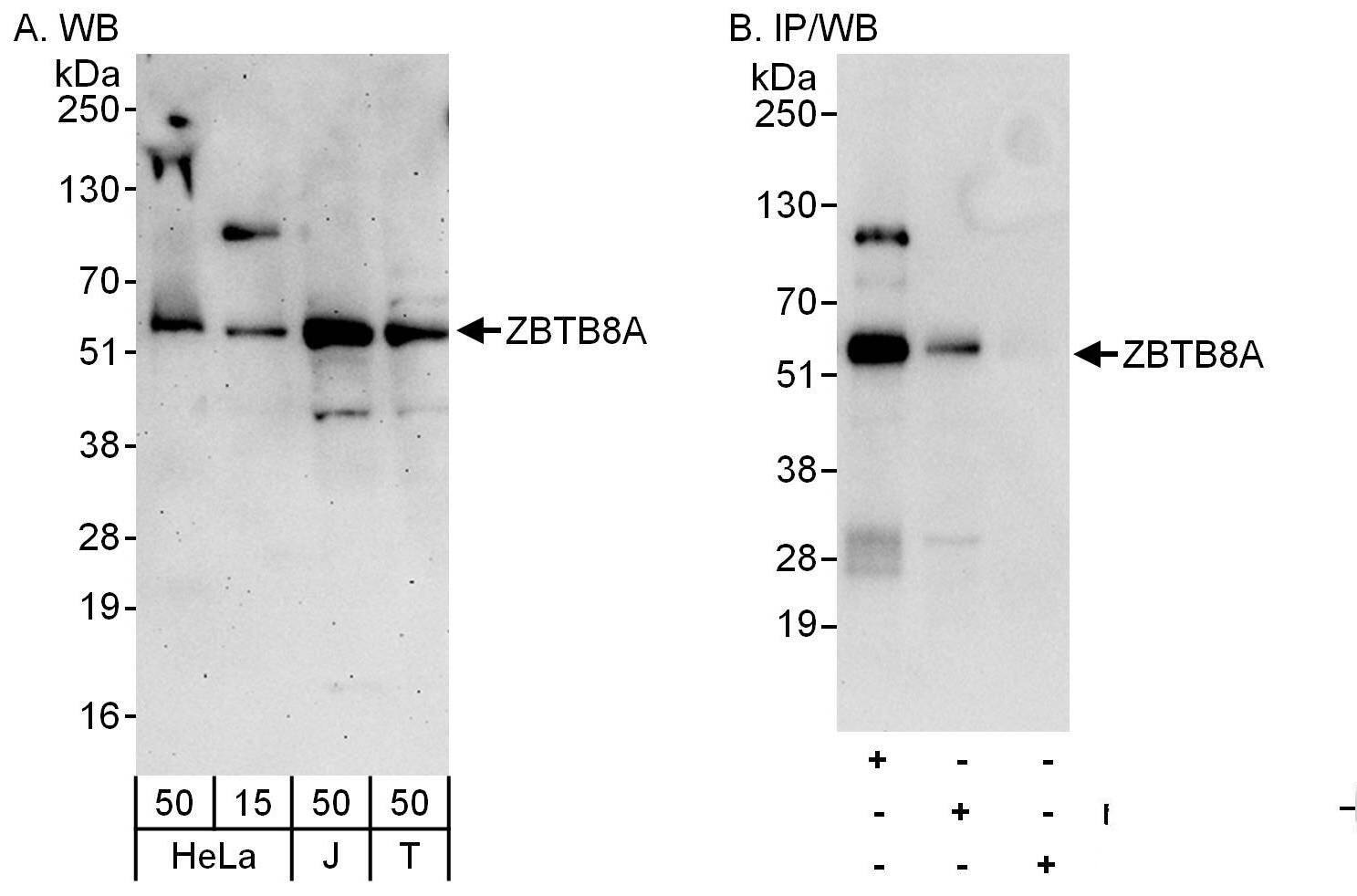 Western Blot:[NBP3-29578]-Detection of human ZBTB8A by western blot and immunoprecipitation. Samples: Whole cell lysate from HeLa , Jurkat and HEK293T cells. Antibodies: Affinity purified rabbit antibody used for WB at 0. 04 µg/ml and 1 µg/ml and used for IP at 6 µg/mg lysate. ZBTB8A was also immunoprecipitated by rabbit antibody , which recognizes a downstream epitope. Detection: Chemiluminescence with exposure times of 3 minutes and 30 seconds.