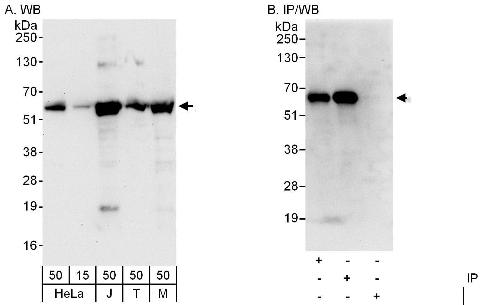 Western Blot:[NBP3-29579]-Detection of human and mouse Atlastin-3 by western blot and immunoprecipitation. Samples: Whole cell lysate from HeLa , Jurkat , HEK293T and mouse NIH 3T3 cells. Antibodies: Affinity purified rabbit anti-Atlastin-3 antibody used for WB at 0. 04 µg/ml and 1 µg/ml and used for IP at 6 µg/mg lysate. Atlastin-3 was also immunoprecipitated by rabbit anti-Atlastin-3 antibody , which recognizes a downstream epitope. Detection: Chemiluminescence with exposure times of 30 seconds and 10 seconds.