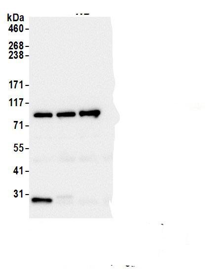 Immunoprecipitation:Beta 2 Adaptin AntibodyNBP3-29580] -Detection of human Beta-2-adaptin by western blot of immunoprecipitates. Samples: Whole cell lysate (1.0 mg per IP reaction; 20% of IP loaded) from HEK293T cells prepared using NETN lysis buffer. Antibodies: Affinity purified rabbit anti-Beta-2-adaptin antibody (NBP3-29580 lot 2) used for IP at 6 µg per reaction. Beta-2-adaptin was also immunoprecipitated by a previous lot of this antibody (NBP3-29580 lot 1) and a second.inst a different epitope of Beta-2-adaptin (A304-718A). For blotting immunoprecipitated Beta-2-adaptin, NBP3-29580 was used at 0.04 µg/ml. Detection: Chemiluminescence with an exposure time of 3 seconds.