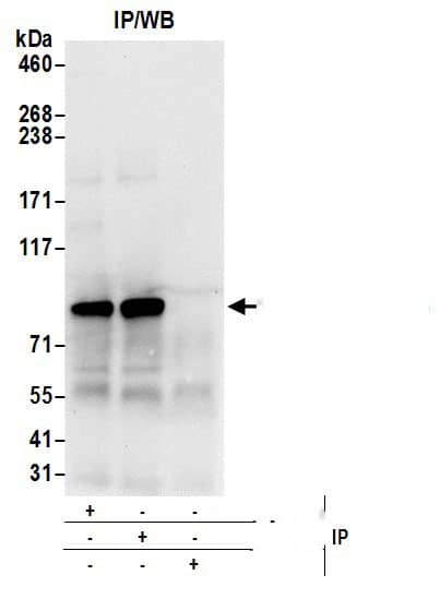 Immunoprecipitation:[NBP3-29581]-Detection of human ALDH18A1/P5CS by western blot of immunoprecipitates. Samples: Whole cell lysate from 293T cells prepared using NETN lysis buffer. Antibodies: Affinity purified rabbit anti-ALDH18A1/P5CS antibody used for IP at 6 µg per reaction. ALDH18A1/P5CS was also immunoprecipitated by rabbit anti-ALDH18A1/P5CS antibody. For blotting immunoprecipitated ALDH18A1/P5CS, was used at 0. 4 µg/ml. Detection: Chemiluminescence with an exposure time of 10 seconds.