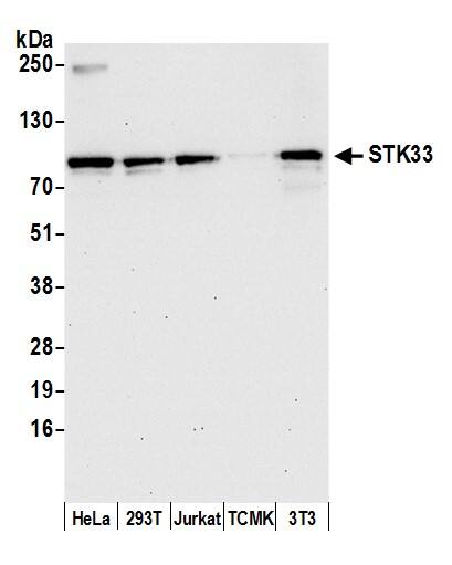 Western Blot:[NBP3-29585]-Detection of human and mouse STK33 by western blot. Samples: Whole cell lysate from HeLa, HEK293T, Jurkat, mouse TCMK-1, and mouse NIH 3T3 cells prepared using NETN lysis buffer. Antibody: Affinity purified rabbit anti-STK33 antibody used for WB at 0. 04 mg/ml. Detection: Chemiluminescence with an exposure time of 30 seconds.