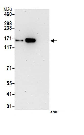 Immunoprecipitation:SMC1 AntibodyNBP3-29588] -Detection of human SMC1 by western blot of immunoprecipitates. Samples: Whole cell lysate (1.0 mg per IP reaction; 20% of IP loaded) from HeLa cells prepared using NETN lysis buffer. Antibodies: Affinity purified rabbit anti-SMC1 antibody NBP3-29588 (lot NBP3-29588-6) used for IP at 6 µg per reaction. SMC1 was also immunoprecipitated by rabbit anti-SMC1 recombinant monoclonal antibody [BL-205-2G8] (A700-018). For blotting immunoprecipitated SMC1, A700-018 was used at 1:1000. Detection: Chemiluminescence with an exposure time time of 10 seconds.