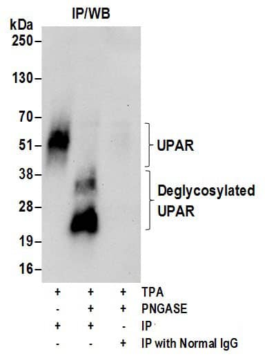 Immunoprecipitation:[NBP3-29589]-Detection of human glycosylated and deglycosylated UPAR by western blot of immunoprecipitates. Samples: Whole cell lysate from U-937 cells incubated with or without TPA and lysed using NETN lysis buffer. The lysate was then treated or mock treated with PnGase F. Antibodies: Affinity purified rabbit anti-UPAR antibody used for IP at 6 µg per reaction. For blotting immunoprecipitated UPAR, was used at 1 µg/ml. Detection: Chemiluminescence with an exposure time of 30 seconds.