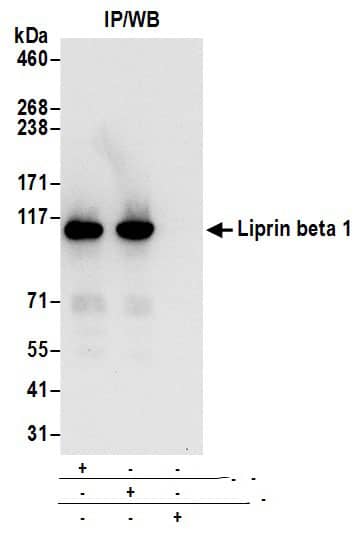 Immunoprecipitation:[NBP3-29590]-Detection of human Liprin beta 1 by western blot of immunoprecipitates. Samples: Whole cell lysate from 293T cells prepared using NETN lysis buffer. Antibodies: Affinity purified rabbit anti-Liprin beta 1 antibody used for IP at 6 µg per reaction. Liprin beta 1 was also immunoprecipitated by rabbit anti-Liprin beta 1 antibody. For blotting immunoprecipitated Liprin beta 1, was used at 0. 4 µg/ml. Detection: Chemiluminescence with an exposure time of 10 seconds.