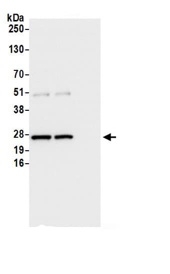 Immunoprecipitation:Glyoxalase I AntibodyNBP3-29592] -Detection of human GLO1/Glyoxalase I by western blot of immunoprecipitates. Samples: Whole cell lysate (0.5 or 1.0 mg per IP reaction; 20% of IP loaded) from 293T cells prepared using NETN lysis buffer. Antibodies: Affinity purified rabbit anti-GLO1/Glyoxalase Iantibody NBP3-29592 (lot NBP3-29592-1) used for IP at 6 µg per reaction. GLO1/Glyoxalase I was also immunoprecipitated by rabbit anti-GLO1/Glyoxalase I.. For blotting immunoprecipitated GLO1/Glyoxalase I, NBP3-29592 was used at 0.4 µg/ml. Detection: Chemiluminescence with an exposure time of 1 second.