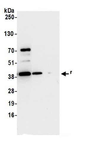 Immunoprecipitation:RPSA AntibodyNBP3-29593] -Detection of human RPSA by western blot of immunoprecipitates. Samples: Whole cell lysate (0.5 or 1.0 mg per IP reaction; 20% of IP loaded) from 293T cells prepared using NETN lysis buffer. Antibodies: Affinity purified rabbit anti-RPSA antibody NBP3-29593 (lot NBP3-29593-1) used for IP at 6 µg per reaction. RPSA was also immunoprecipitated by rabbit anti-RPSA.. For blotting immunoprecipitated RPSA, NBP3-29593 was used at 0.4 µg/ml. Detection: Chemiluminescence with an exposure time of 10 seconds.