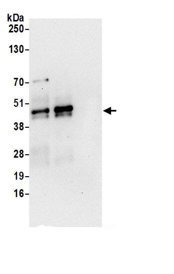 Immunoprecipitation:SCL/Tal1 AntibodyNBP3-29594] -Detection of human TAL1 by western blot of immunoprecipitates. Samples: Whole cell lysate (0.5 or 1.0 mg per IP reaction; 20% of IP loaded) from Jurkat cells prepared using NETN lysis buffer. Antibodies: Affinity purified rabbit anti-TAL1 antibody NBP3-29594 (lot NBP3-29594-1) used for IP at 6 µg per reaction. TAL1 was also immunoprecipitated by rabbit anti-TAL1 antibody. For blotting immunoprecipitated TAL1, NBP3-29594 was used at 0.4 µg/ml. Detection: Chemiluminescence with an exposure time of 30 seconds.