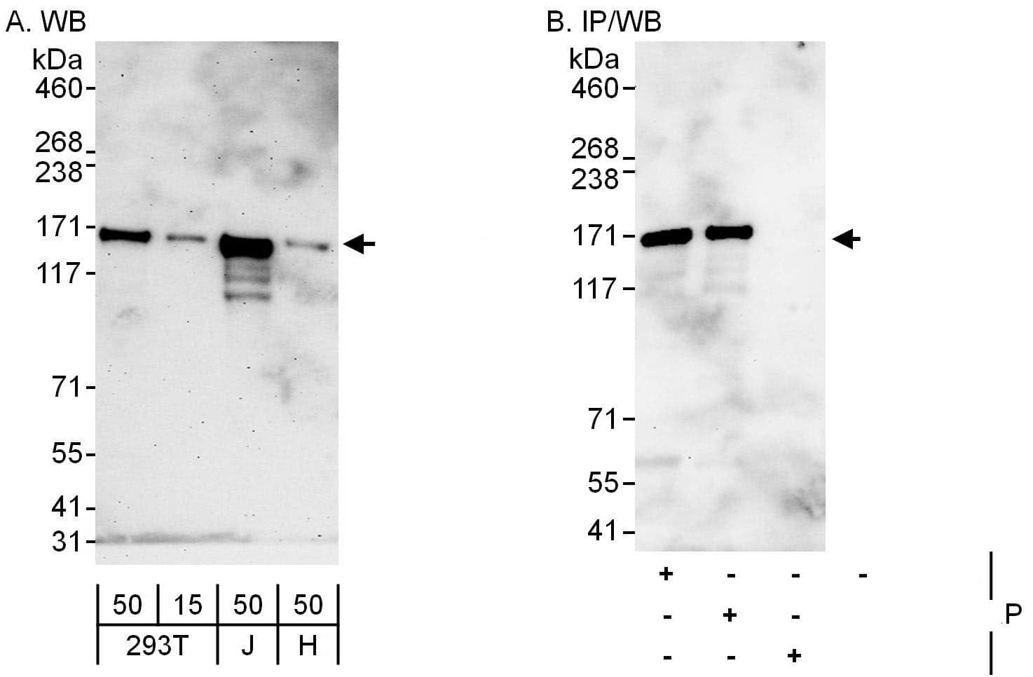 Western Blot:[NBP3-29595]-Detection of human Cingulin by western blot and immunoprecipitation. Samples: Whole cell lysate from HEK293T , Jurkat and HeLa cells. Antibodies: Affinity purified rabbit anti-Cingulin antibody used for WB at 0. 1 µg/ml and 1 µg/ml and used for IP at 6 µg/mg lysate. Cingulin was also immunoprecipitated by rabbit anti-Cingulin antibody , which recognizes an upstream epitope. Detection: Chemiluminescence with exposure times of 3 minutes and 30 seconds.