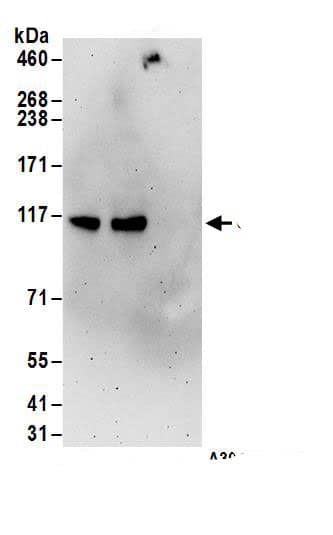 Immunoprecipitation:UBE3C AntibodyNBP3-29597] -Detection of human UBE3C by western blot of immunoprecipitates. Samples: Whole cell lysate (1 mg for IP; 20% of IP loaded) from 293T cells. Antibodies: Affinity purified rabbit anti-UBE3C antibody NBP3-29597 (lot NBP3-29597-1) used for IP at 6 µg/mg lysate. UBE3C was also immunoprecipitated by rabbit anti-UBE3C.. For blotting immunoprecipitated UBE3C, NBP3-29597 was used at 0.4 µg/ml. Detection: Chemiluminescence with an exposure time of 3 minutes.