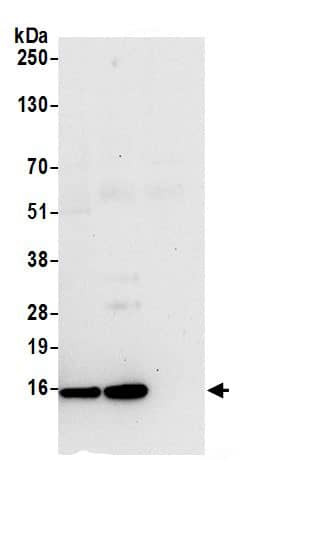 Immunoprecipitation:TBCA AntibodyNBP3-29600] -Detection of human TBCA by western blot of immunoprecipitates. Samples: Whole cell lysate (0.5 or 1.0 mg per IP reaction; 20% of IP loaded) from 293T cells prepared using NETN lysis buffer. Antibodies: Affinity purified rabbit anti-TBCA antibody NBP3-29600 (lot NBP3-29600-1) used for IP at 6 µg per reaction. TBCA was also immunoprecipitated by rabbit anti-TBCA antibody. For blotting immunoprecipitated TBCA, NBP3-29600 was used at 1 µg/ml. Detection: Chemiluminescence with an exposure time of 30 seconds.
