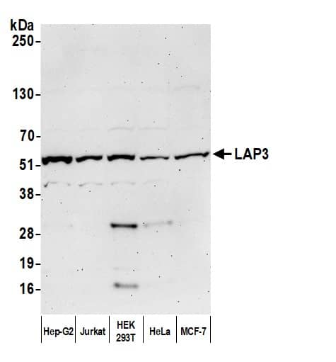 Western Blot:[NBP3-29601]-Detection of human LAP3 by western blot. Samples: Whole cell lysate from Hep-G2, Jurkat, HEK293T, HeLa, and MCF-7 cells prepared using NETN lysis buffer. Antibody: Affinity purified rabbit anti-LAP3 antibody used for WB at 0. 4 mg/ml. Detection: Chemiluminescence with an exposure time of 75 seconds.