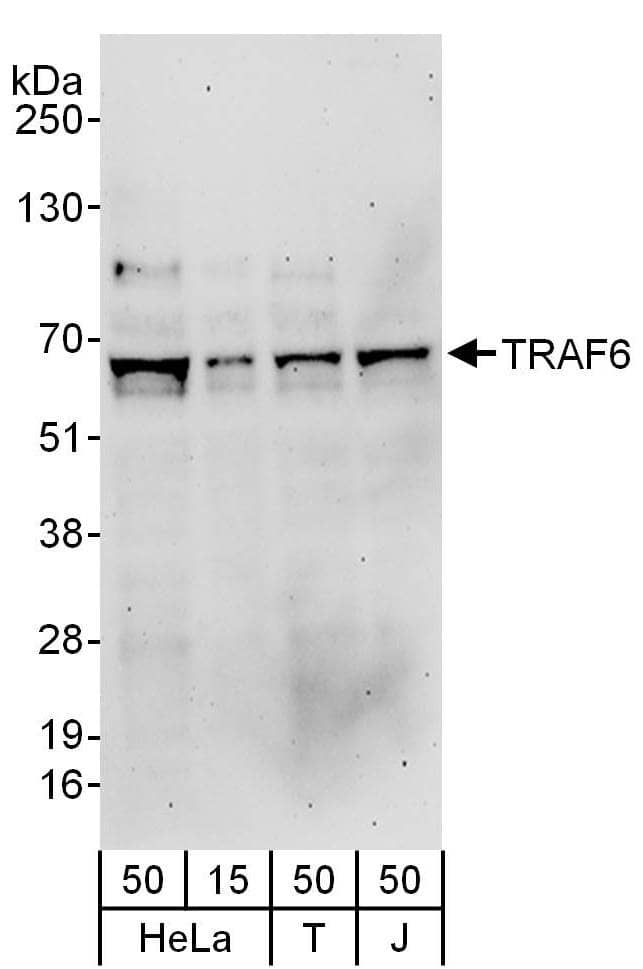 Western Blot:[NBP3-29602]-Detection of human TRAF6 by western blot. Samples: Whole cell lysate from HeLa , HEK293T and Jurkat cells. Antibodies: Affinity purified rabbit anti-TRAF6 antibody used for WB at 0. 1 µg/ml. Detection: Chemiluminescence with an exposure time of 3 minutes.