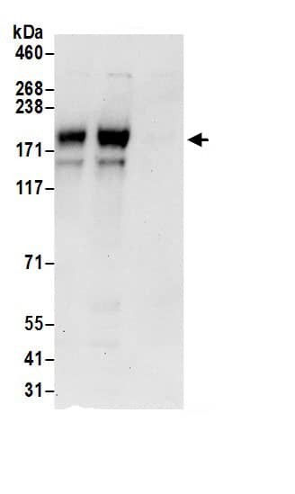 Immunoprecipitation:Adenylate Cyclase 9 AntibodyNBP3-29606] -Detection of human AC9 by western blot of immunoprecipitates. Samples: Whole cell lysate (0.5 or 1.0 mg per IP reaction; 20% of IP loaded) from HeLa cells prepared using RIPA lysis buffer. Antibodies: Affinity purified rabbit anti-AC9 antibody NBP3-29606 (lot NBP3-29606-1) used for IP at 6 µg per reaction. AC9 was also immunoprecipitated by rabbit anti-AC9 antibody BL16371. For blotting immunoprecipitated AC9, Blotting Ab was used at 0.4 µg/ml. Detection: Chemiluminescence with an exposure time of 30 seconds.