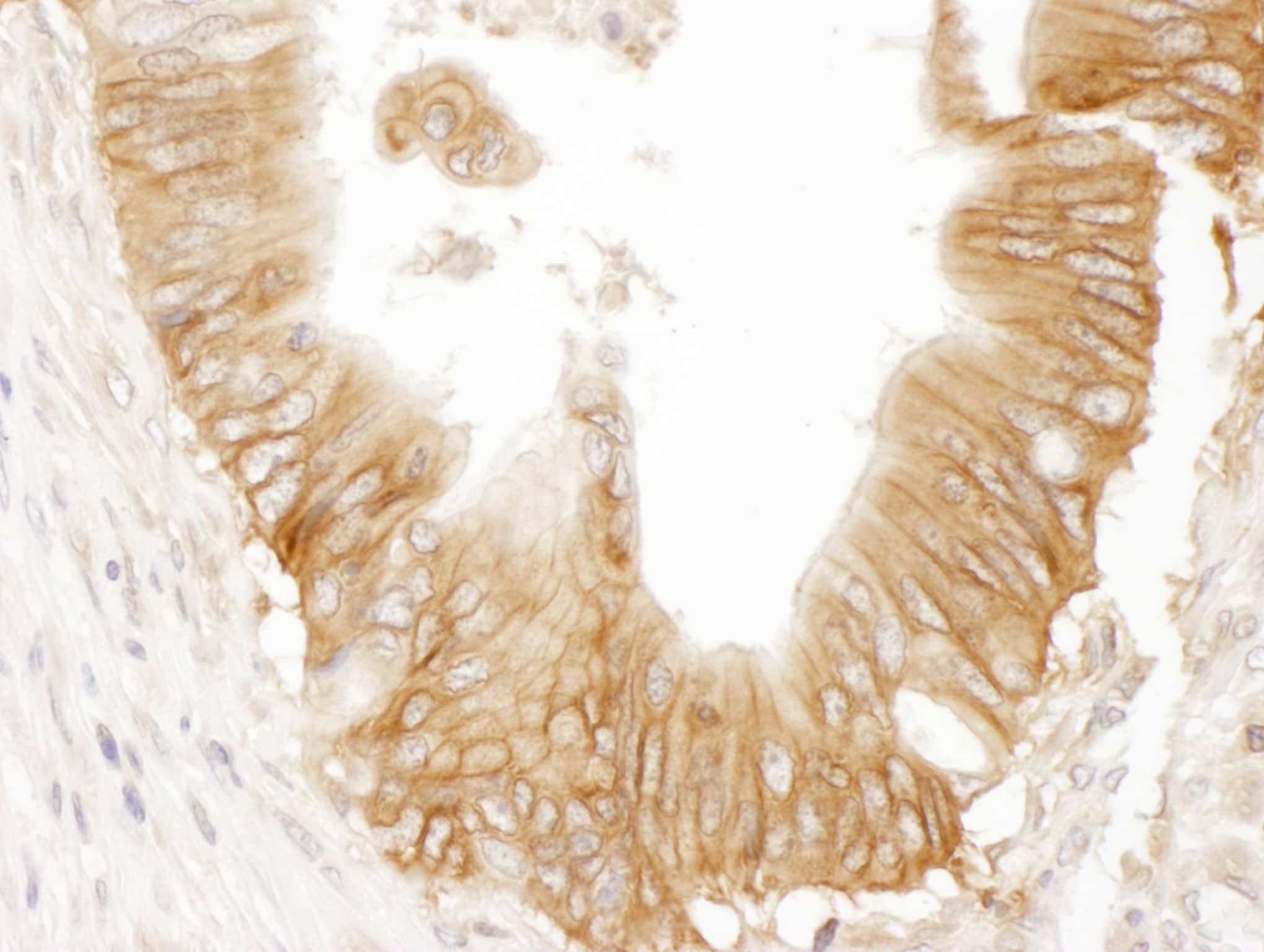 Immunohistochemistry Adenylate Cyclase 9 Antibody