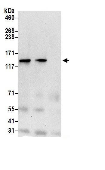 Immunoprecipitation:LRPPRC AntibodyNBP3-29607] -Detection of human LRPPRC by western blot of immunoprecipitates. Samples: Whole cell lysate (0.5 or 1.0 mg per IP reaction; 20% of IP loaded) from 293T cells prepared using NETN lysis buffer. Antibodies: Affinity purified rabbit anti-LRPPRC antibody NBP3-29607 (lot NBP3-29607-1) used for IP at 6 µg per reaction. LRPPRC was also immunoprecipitated by rabbit anti-LRPPRC antibody BL18428. For blotting immunoprecipitated LRPPRC, NBP3-29607 was used at 0.4 µg/ml. Detection: Chemiluminescence with an exposure time of 30 seconds.