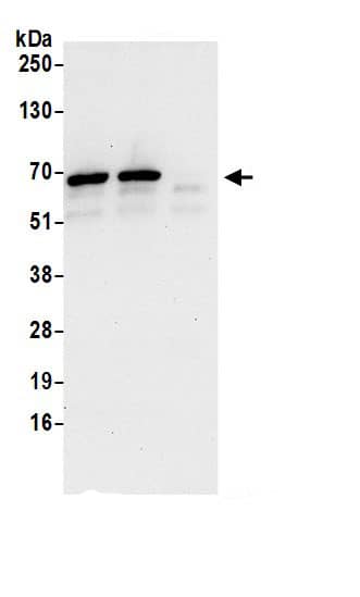 Immunoprecipitation:MFAP1 AntibodyNBP3-29610] -Detection of human MFAP1 by western blot of immunoprecipitates. Samples: Whole cell lysate (0.5 or 1.0 mg per IP reaction; 20% of IP loaded) from 293T cells prepared using NETN lysis buffer. Antibodies: Affinity purified rabbit anti-MFAP1 antibody NBP3-29610 (lot NBP3-29610-1) used for IP at 6 µg per reaction. MFAP1 was also immunoprecipitated by rabbit anti-MFAP1 antibody BL17919. For blotting immunoprecipitated MFAP1, NBP3-29610 was used at 1 µg/ml. Detection: Chemiluminescence with an exposure time of 30 seconds.