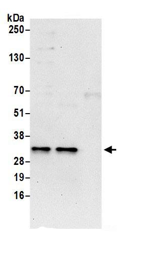 Immunoprecipitation:MLF2 AntibodyNBP3-29611] -Detection of human MLF2 by western blot of immunoprecipitates. Samples: Whole cell lysate (0.5 or 1.0 mg per IP reaction; 20% of IP loaded) from 293T cells prepared using NETN lysis buffer. Antibodies: Affinity purified rabbit anti-MLF2 antibody NBP3-29611 (lot NBP3-29611-1) used for IP at 6 µg per reaction. MLF2 was also immunoprecipitated by rabbit anti-MLF2 antibody BL18015. For blotting immunoprecipitated MLF2, NBP3-29611 was used at 0.4 µg/ml. Detection: Chemiluminescence with an exposure time of 30 seconds.