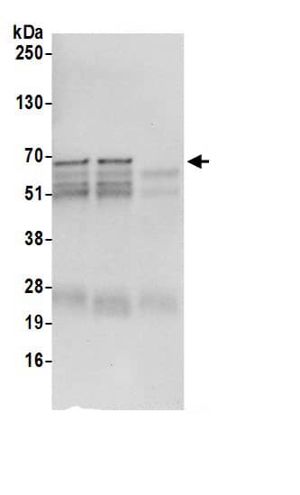 Immunoprecipitation:STAM2 AntibodyNBP3-29612] -Detection of human STAM2 by western blot of immunoprecipitates. Samples: Whole cell lysate (0.5 or 1.0 mg per IP reaction; 20% of IP loaded) from Jurkat cells prepared using NETN lysis buffer. Antibody: Affinity purified rabbit anti-STAM2 antibody NBP3-29612 (lot NBP3-29612-1) used for IP at 6 µg per reaction. STAM2 was also immunoprecipitated by rabbit anti-STAM2 antibody. For blotting immunoprecipitated STAM2, NBP3-29612 was used at 0.4 µg/ml. Detection: Chemiluminescence with an exposure time of 10 seconds.