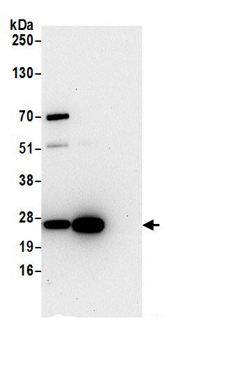 Immunoprecipitation:HPRT AntibodyNBP3-29613] -Detection of human HPRT1 by western blot of immunoprecipitates. Samples: Whole cell lysate (0.5 or 1.0 mg per IP reaction; 20% of IP loaded) from 293T cells prepared using NETN lysis buffer. Antibodies: Affinity purified rabbit anti-HPRT1 antibody NBP3-29613 (lot NBP3-29613-1) used for IP at 6 µg per reaction. HPRT1 was also immunoprecipitated by rabbit anti-HPRT1.. For blotting immunoprecipitated HPRT1, NBP3-29613 was used at 1 µg/ml. Detection: Chemiluminescence with an exposure time of 30 seconds.