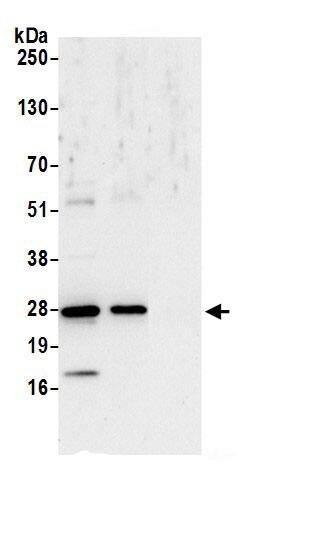 Immunoprecipitation:Peroxiredoxin 6 AntibodyNBP3-29614] -Detection of human PRDX6 by western blot of immunoprecipitates. Samples: Whole cell lysate (0.5 or 1.0 mg per IP reaction; 20% of IP loaded) from 293T cells prepared using NETN lysis buffer. Antibodies: Affinity purified rabbit anti-PRDX6 antibody NBP3-29614 (lot NBP3-29614-1) used for IP at 6 µg per reaction. PRDX6 was also immunoprecipitated by rabbit anti-PRDX6.. For blotting immunoprecipitated PRDX6, NBP3-29614 was used at 1 µg/ml. Detection: Chemiluminescence with an exposure time of 10 seconds.