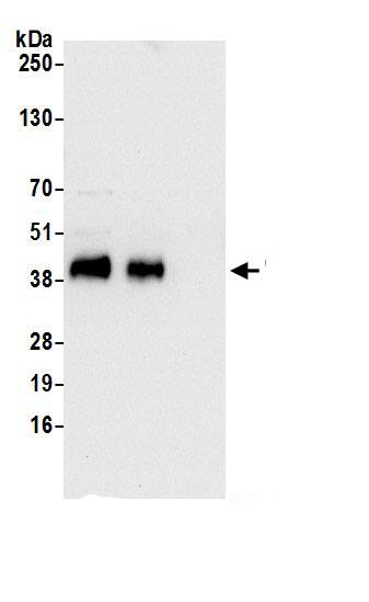 Immunoprecipitation:Ribonuclease Inhibitor AntibodyNBP3-29615] -Detection of human RNH1 by western blot of immunoprecipitates. Samples: Whole cell lysate (0.5 or 1.0 mg per IP reaction; 20% of IP loaded) from 293T cells prepared using NETN lysis buffer. Antibodies: Affinity purified rabbit anti-RNH1 antibody NBP3-29615 (lot NBP3-29615-1) used for IP at 6 µg per reaction. RNH1 was also immunoprecipitated by rabbit anti-RNH1.. For blotting immunoprecipitated RNH1, NBP3-29615 was used at 0.4 µg/ml. Detection: Chemiluminescence with an exposure time of 10 seconds.