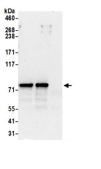 Immunoprecipitation:SF4 AntibodyNBP3-29617] -Detection of human SUGP1 by western blot of immunoprecipitates. Samples: Whole cell lysate (0.5 or 1.0 mg per IP reaction; 20% of IP loaded) from 293T cells prepared using NETN lysis buffer. Antibodies: Affinity purified rabbit anti-SUGP1 antibody NBP3-29617 (lot NBP3-29617-1) used for IP at 6 µg per reaction. SUGP1 was also immunoprecipitated by rabbit anti-SUGP1 antibody BL17937. For blotting immunoprecipitated SUGP1, NBP3-29617 was used at 0.4 µg/ml. Detection: Chemiluminescence with an exposure time of 30 seconds.