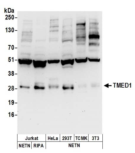 Western Blot:[NBP3-29623]-Detection of human and mouse TMED1 by western blot. Samples: Whole cell lysate from Jurkat, HeLa, HEK293T, mouse TCMK-1, and mouse NIH 3T3 cells prepared using NETN and RIPA lysis buffer. Antibodies: Affinity purified rabbit anti-TMED1 antibody used for WB at 1 µg/ml. Detection: Chemiluminescence with an exposure time of 30 seconds.