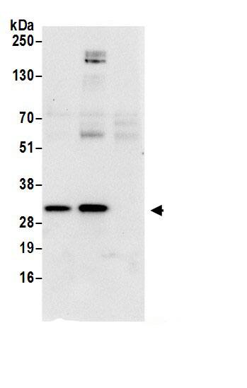 Immunoprecipitation:Ribosome maturation protein SBDS AntibodyNBP3-29626] -Detection of human SBDS by western blot of immunoprecipitates. Samples: Whole cell lysate (0.5 or 1.0 mg per IP reaction; 20% of IP loaded) from 293T cells prepared using NETN lysis buffer. Antibodies: Affinity purified rabbit anti-SBDS antibody NBP3-29626 (lot NBP3-29626-1) used for IP at 6 µg per reaction. SBDS was also immunoprecipitated by rabbit anti-SBDS antibody BL19876. For blotting immunoprecipitated SBDS, NBP3-29626 was used at 0.4 µg/ml. Detection: Chemiluminescence with an exposure time of 10 seconds.