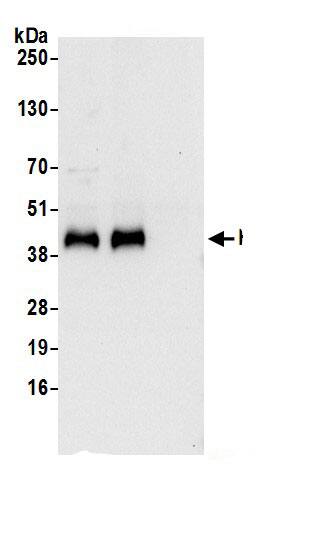 Immunoprecipitation:Ribonuclease Inhibitor AntibodyNBP3-29631] -Detection of human RNH1 by western blot of immunoprecipitates. Samples: Whole cell lysate (0.5 or 1.0 mg per IP reaction; 20% of IP loaded) from 293T cells prepared using NETN lysis buffer. Antibodies: Affinity purified rabbit anti-RNH1 antibody NBP3-29631 (lot NBP3-29631-1) used for IP at 6 µg per reaction. RNH1 was also immunoprecipitated by rabbit anti-RNH1.. For blotting immunoprecipitated RNH1, NBP3-29631 was used at 0.4 µg/ml. Detection: Chemiluminescence with an exposure time of 10 seconds.